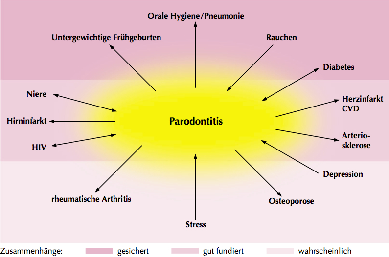 17Parodontitis-und-ihre-Beziehungen-zur-allgemeinen-Gesundheit-und-zu-spezifischen-Risikofaktoren